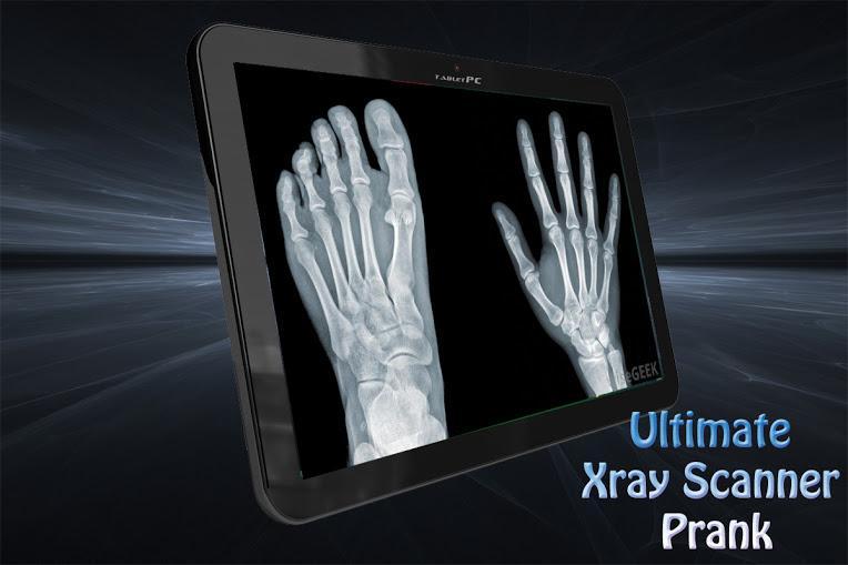 Ultimate Xray Scanner Prank